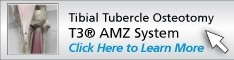 Tibial Tubercle Osteotomy using the T3® AMZ System