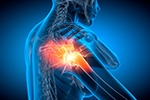 Is Shoulder Arthroscopy the Right Solution for Your Shoulder Pain in New York?