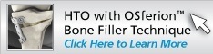 HTO with OSferion™ Bone Filler