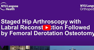 Case Representation Video